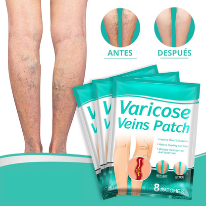 PARCHES PARA ELIMINAR VARICES CON FÓRMULA NATURAL