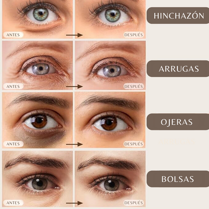 PARCHES DE OJOS DE ORO DE 24K CON COLÁGENO Y ÁCIDO HIALURÓNICO