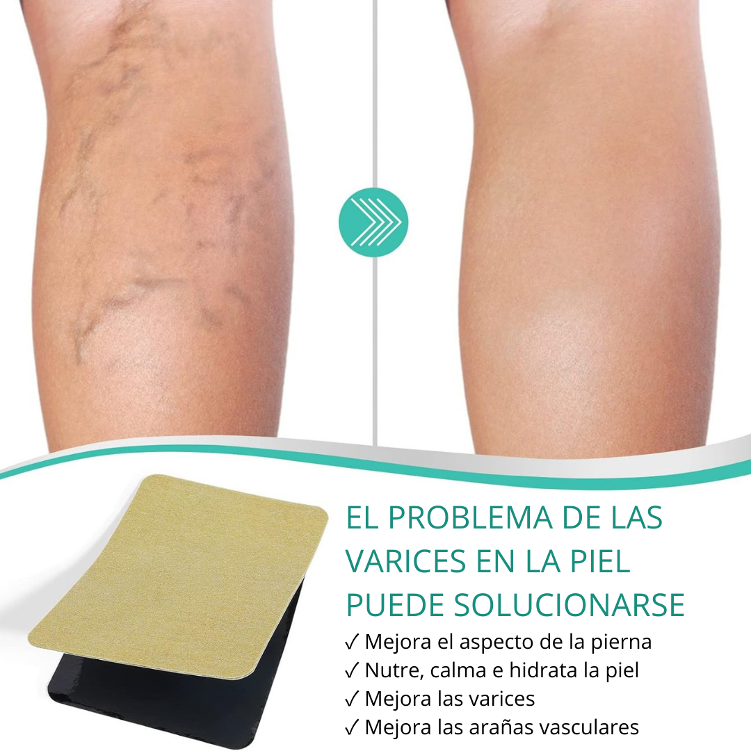 PARCHES PARA ELIMINAR VARICES CON FÓRMULA NATURAL