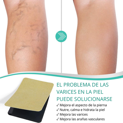 PARCHES PARA ELIMINAR VARICES CON FÓRMULA NATURAL